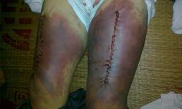 4 công an xã tung đòn hiểm đánh chết dân như thế nào?