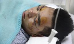 Bị hành hung tập thể, 32 sinh viên bỏ thực tập