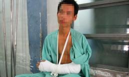 Chém gần lìa tay nạn nhân để cướp iphone "rởm"