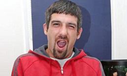 Dở khóc dở cười với những sự cố liên quan đến "cái ấy"