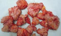 Nam thanh niên tử vong vì tự bơm silicon vào mông