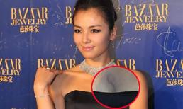 Lưu Đào lộ vết sẹo lồi ở khe ngực
