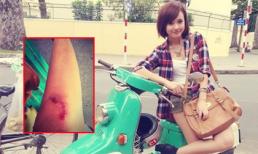 Sao Việt và những tai nạn "nhớ đời" trên phim trường