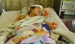 Lời kể chủ tiệm vàng bị trộm chém dã man