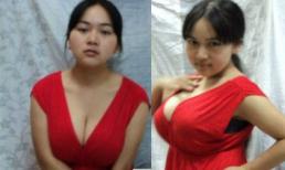 Sốc với bộ ngực "khổng lồ" của bé gái 11 tuổi