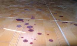 Trưởng công an xã bị côn đồ truy sát tại nhà riêng