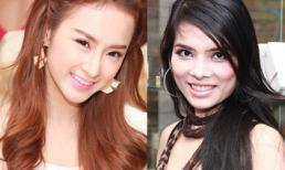 Sao Việt và 'cơn cuồng' sửa mũi