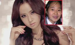 Mỹ nhân Hàn dính nghi án 'gọt mặt'