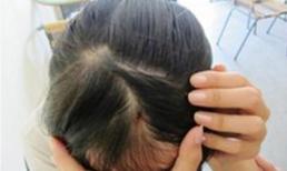 Hà Nội: Cô giáo đâm bút chảy máu đầu HS bị xử lý nặng