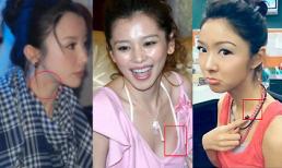 Mốt "khoe" vết bầm dập vì "yêu quá đà" của sao