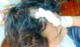 Côn đồ đánh cụ bà 83 tuổi gãy tay