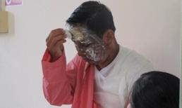 Ghen tuông, vợ nấu nước sôi “luộc” chồng