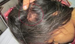 Chồng thai phụ tố CSGT “ra gậy” bị công an... triệu tập!