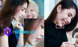 Nghi án Thủy Tiên để lộ dấu vết độn cằm?