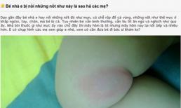 Con tử vong vì mẹ học cách chữa bệnh trên diễn đàn