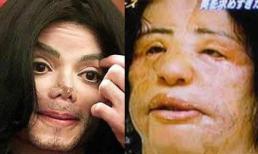 Những thảm họa thẩm mỹ đau lòng trong showbiz