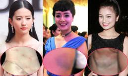 Những "vết tích" khó hiểu trên cơ thể sao (P4) 