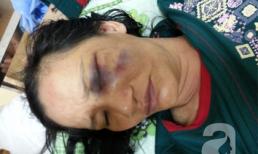 Hà Nội: Chồng đánh vợ vào vùng kín, máu tuôn xối xả