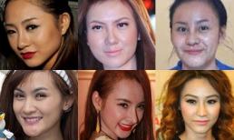 Những sao Việt mặt thẩm mỹ vẫn "sưng" đã vội xuất hiện!