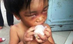 Bé 3 tuổi bị châm tàn thuốc, đánh bầm mắt bắt đi ăn xin