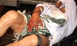 1001 lý do khiến đàn ông tự cắt "của quý"