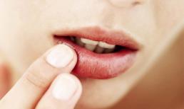 Giữ làn môi mềm mại qua những ngày giao mùa