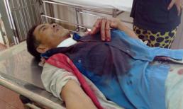 Điện lực thi công ẩu, dây cáp điện cắt đứt cổ người đi đường