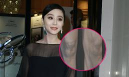 Phạm Băng Băng bớt rạng ngời vì lộ chân đầy sẹo 