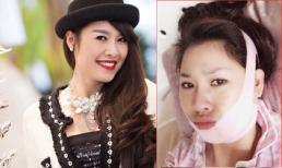 Quế Vân dính nghi án gọt cằm