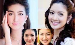 Loạt mỹ nhân Thái "phát cuồng" với mốt cắt mí mắt