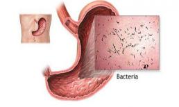 Bệnh cúm dạ dày và những điều bạn chưa biết