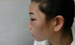 Chồng bắt vợ tự cắt tóc, rạch mặt vì... tin nhắn lạ