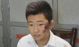 Phát hiện chấn động vụ thẩm mỹ viện ném xác: Hung thủ đã khai man