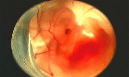 Nhau thai không thể là thuốc