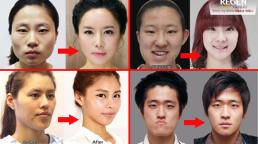 'Ma thuật lột xác' kinh hoàng của phẫu thuật thẩm mỹ