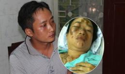 Giây phút bị kẻ cuồng tình tạt axit giữa Sài Gòn