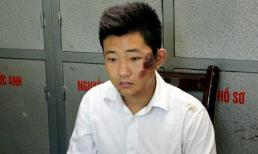 Bảo vệ thẩm mỹ không dám ngủ sau khi phi tang xác