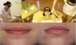 Triệt lông Version 5S tiết kiệm chi phí tới 40%