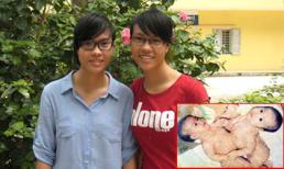 Những cặp song sinh dính liền được tách thành công: Ngày ấy - bây giờ