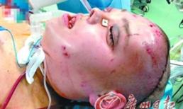 Cô gái được phẫu thuật thay đổi gương mặt