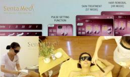 Miễn phí Triệt lông Version 5S