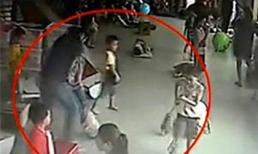 Bảo mẫu đánh bẹp đầu bé gái 4 tuổi bị tự kỷ