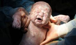 Ảnh ghi lại khoảnh khắc em bé chào đời gây tranh cãi