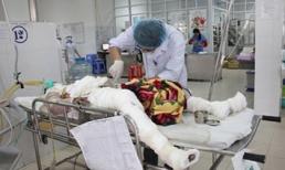 Cô gái bị chém và thiêu sống tại Đà Nẵng đã tử vong