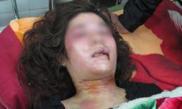 Đang ngủ, thiếu nữ bị truy sát dã man