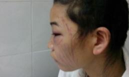 Giây phút tự rạch mặt của người vợ bị chồng bạo hành