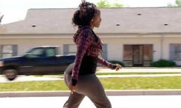 Cô gái bơm mông 54 lần trong 3 năm