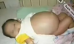 Bé trai 7 tháng tuổi mang bầu