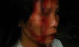 Chồng chém vợ chảy máu ròng ròng ở Buôn Mê Thuột