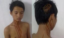 Gã hàng xóm hành hung và dâm ô nhiều trẻ em